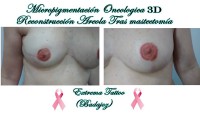 /album/micropigmentacion/micropigmentacion-extremadura-jpg/